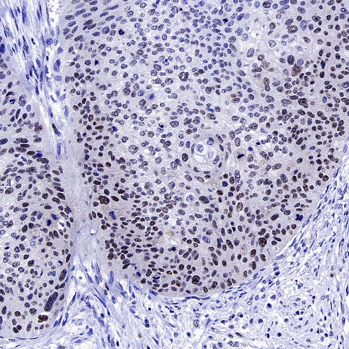 Phospho-NAK/TBK1 (Ser172) Recombinant Rabbit mAb (S-3182)