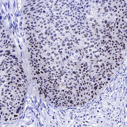 Phospho-NAK/TBK1 (Ser172) Recombinant Rabbit mAb (S-3182)