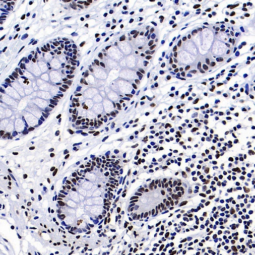 FUS Recombinant Rabbit mAb (S-1015-21)