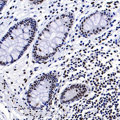 FUS Recombinant Rabbit mAb (S-1015-21)