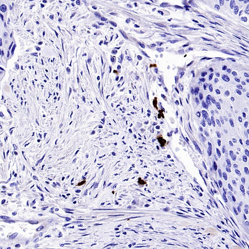 Human IgA1 Recombinant Rabbit mAb (S-2513-50)