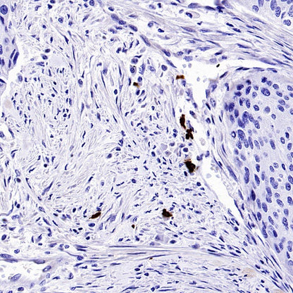 Human IgA1 Recombinant Rabbit mAb (S-2513-50)