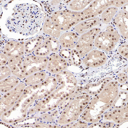 Phospho-STAT1 (Ser727) Recombinant Rabbit mAb