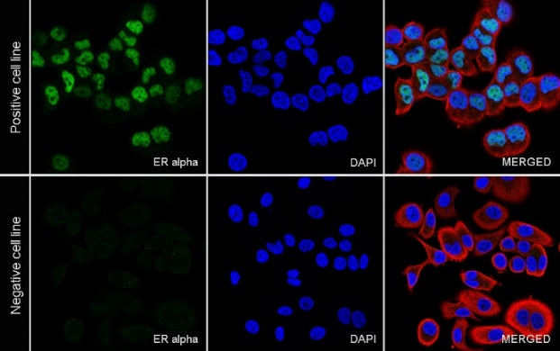 ER alpha Recombinant Rabbit mAb (SDT-2950-36)