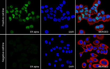 ER alpha Recombinant Rabbit mAb (SDT-2950-36)