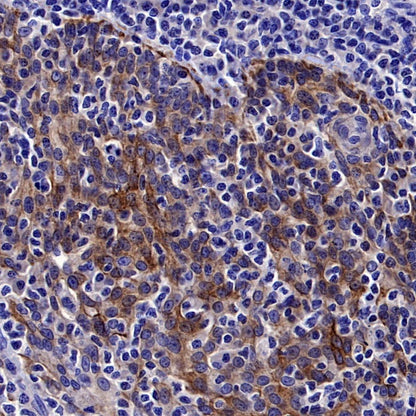 Cytokeratin 6A (KRT6A) Recombinant Mouse mAb (SDT-3380)