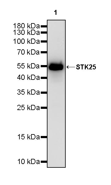 STK25 Recombinant Rabbit mAb (S-4088-17)