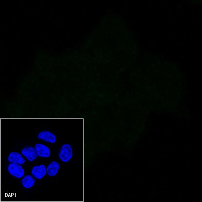 MUC1 Mouse mAb (SDT-777-71)
