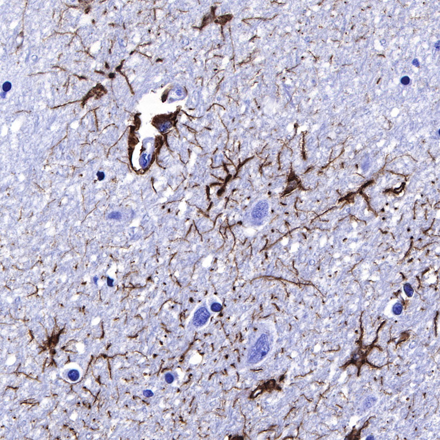 GFAP Recombinant Rabbit mAb (SDT-306-10)
