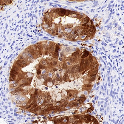 CDKN2A/p16 INK4A Recombinant Mouse mAb (SDT-4675)