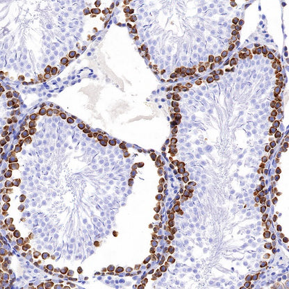 DAZL Recombinant Rabbit mAb (S-1552-6)