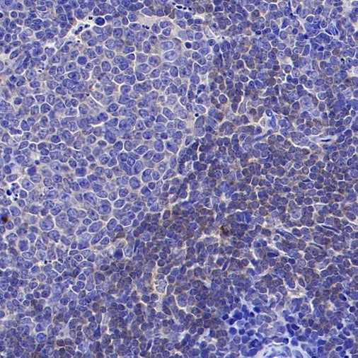 PIK3CD Recombinant Rabbit mAb (SDT-1978-148)