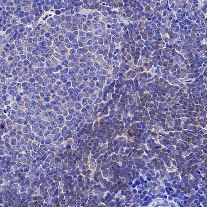 PIK3CD Recombinant Rabbit mAb (SDT-1978-148)