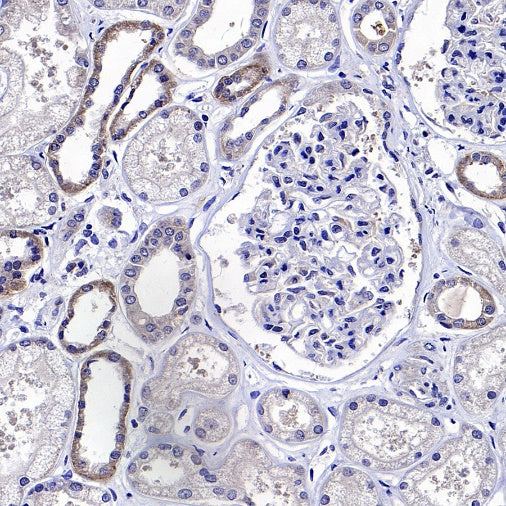 PYCR1 Rabbit Polyclonal Antibody