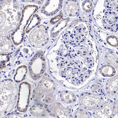 PYCR1 Rabbit Polyclonal Antibody