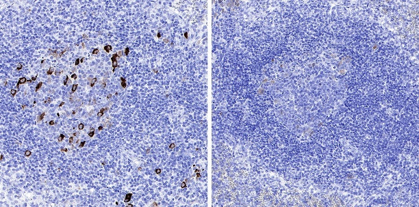 Phospho-IκBα (Ser32/36) Recombinant Rabbit mAb (S-R362)