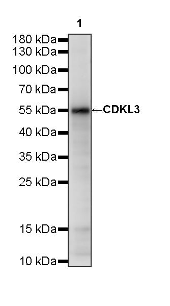 CDKL3 Recombinant Rabbit mAb (S-4356-11)