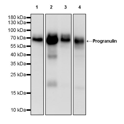 Progranulin Recombinant Rabbit mAb (S-2202-59)
