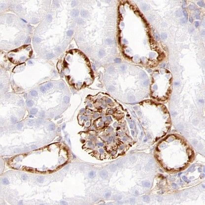 CD105 Recombinant Rabbit mAb (S-3764-11)