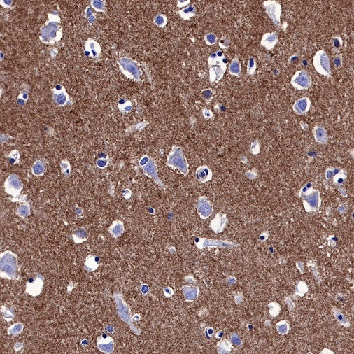 IκBα Recombinant Rabbit mAb (SDT-457-9)