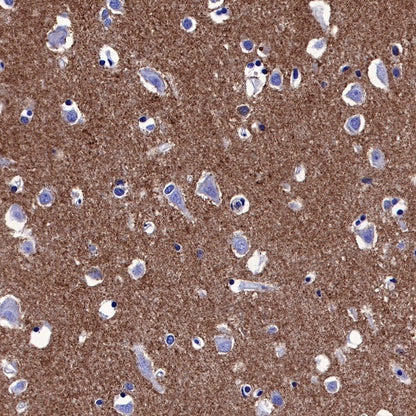 IκBα Recombinant Rabbit mAb (SDT-457-9)