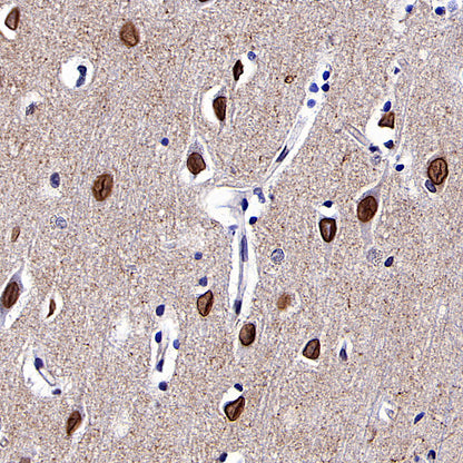 NF-kB p65 Recombinant Rabbit mAb (S-5142)