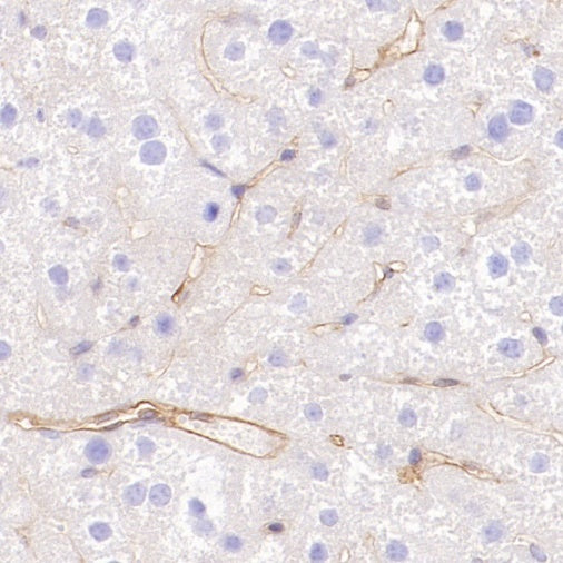 CD105 Recombinant Rabbit mAb (S-3764-11)