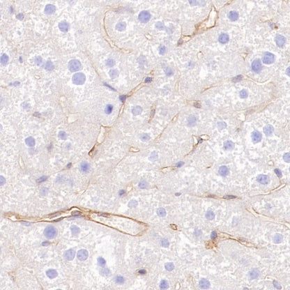 CD105 Recombinant Rabbit mAb (S-3764-11)