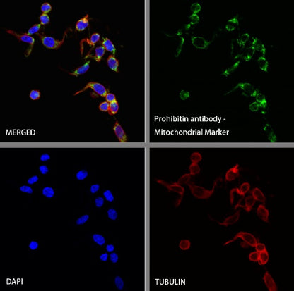 Prohibitin Recombinant Rabbit mAb (S-2679-7)