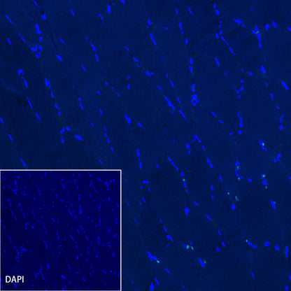 Cadherin 17 Recombinant Rabbit mAb,PBS Only (SDT-R151)
