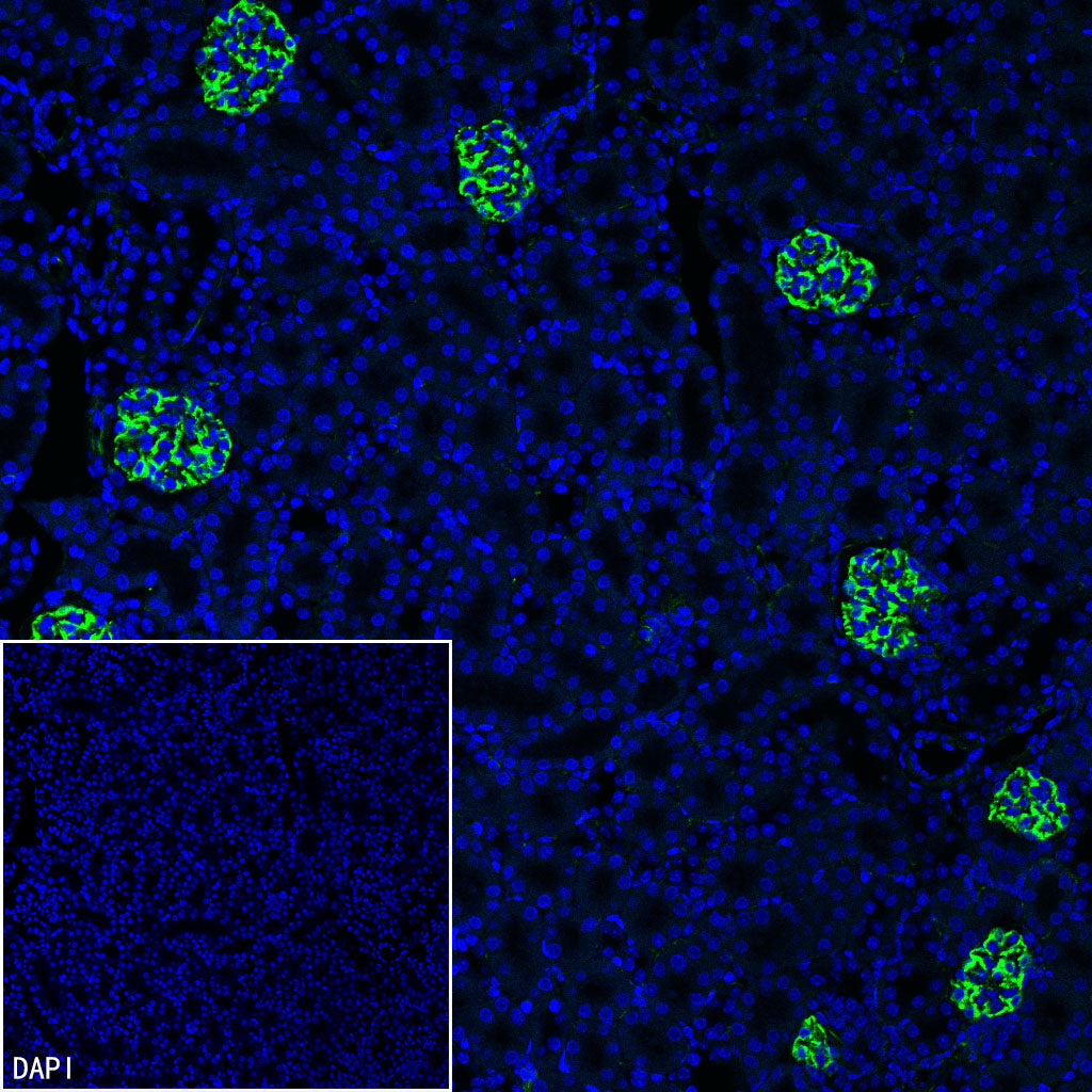 Nestin Recombinant Rabbit mAb (S-3890-61)