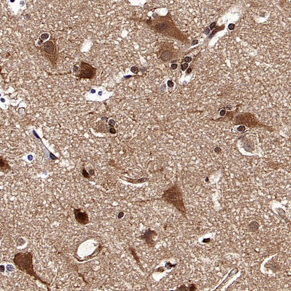 VCP Recombinant Rabbit mAb (S-1818-121)