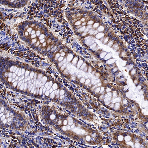 Calreticulin Recombinant Rabbit mAb (S-779-273)
