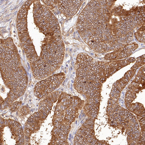 DRP1 Recombinant Rabbit mAb (S-1927-27)