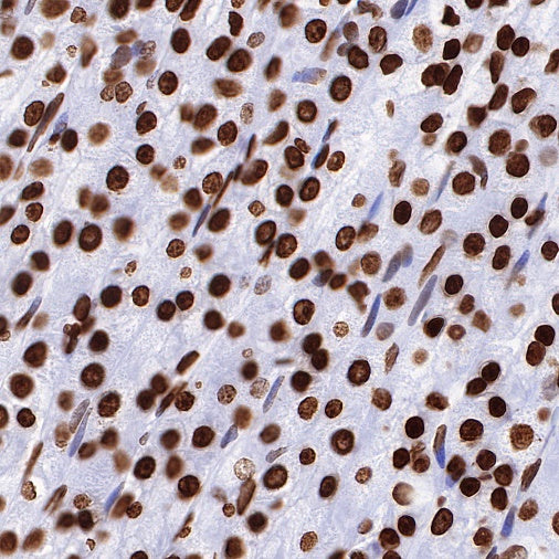 Histone H3 (mono methyl K36) Recombinant Rabbit mAb (S-R211)