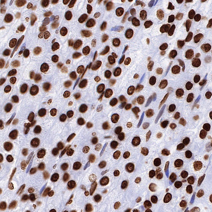 Histone H3 (mono methyl K36) Recombinant Rabbit mAb (S-R211)