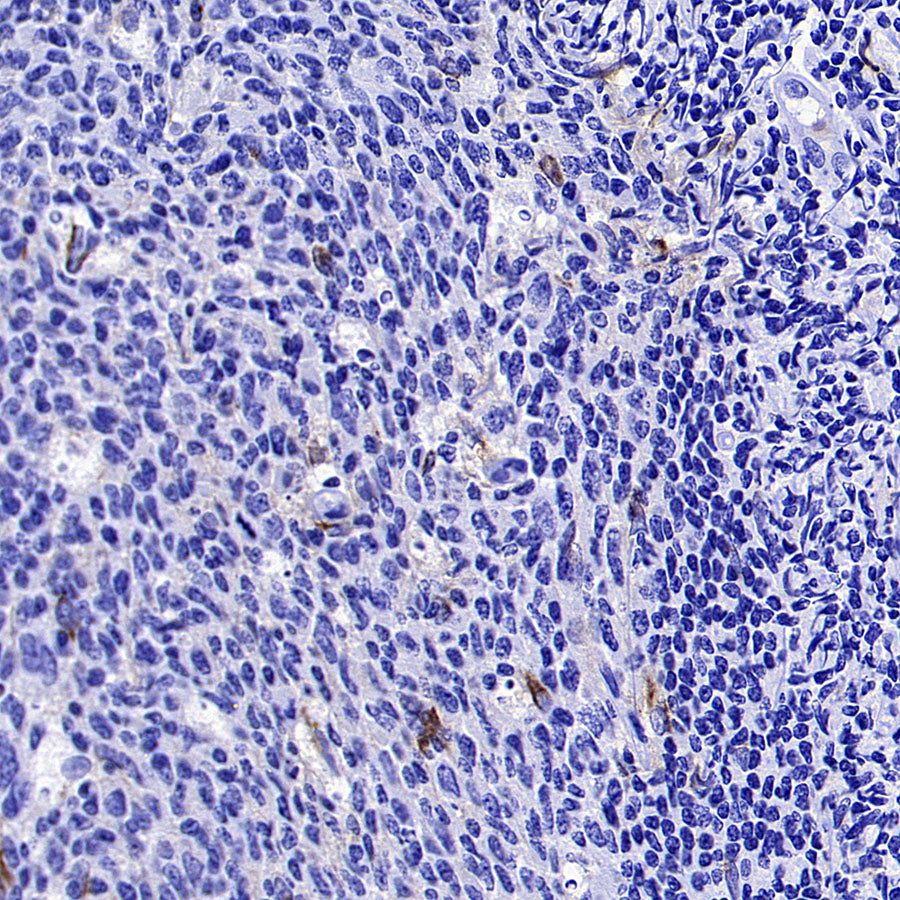 CD137 Recombinant Rabbit mAb (S-1726-175)