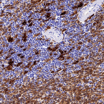 HLA-DPB1 Recombinant Rabbit mAb (S-R263)