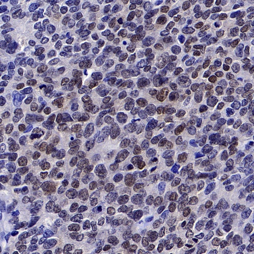 SMAD3 Recombinant Rabbit mAb (S-517-122)