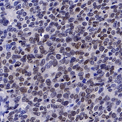 SMAD3 Recombinant Rabbit mAb (S-517-122)
