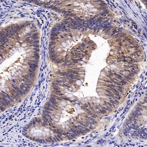 14-3-3 zeta Recombinant Rabbit mAb (S-1092-31)