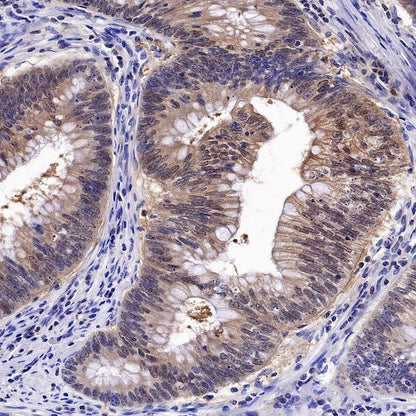 14-3-3 zeta Recombinant Rabbit mAb (S-1092-31)