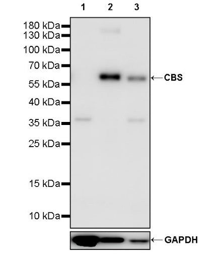 CBS Rabbit Polyclonal Antibody