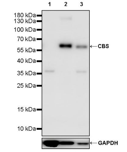 CBS Rabbit Polyclonal Antibody