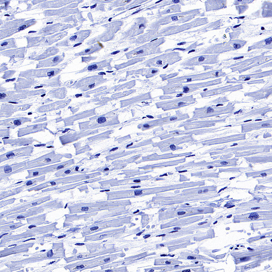 Glypican-3 Recombinant Rabbit mAb (SDT-4064-69-2)
