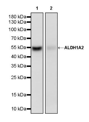 ALDH1A2 Recombinant Rabbit mAb (S-3569-78)