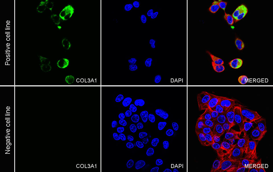 COL3A1 Recombinant Rabbit mAb (S-4338)