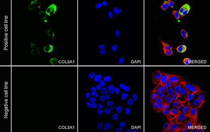 COL3A1 Recombinant Rabbit mAb (S-4338)
