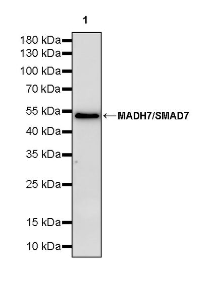 MADH7/SMAD7 Recombinant Rabbit mAb (S-2930-74)