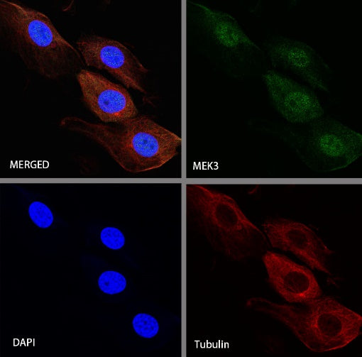 MEK3 Recombinant Rabbit mAb (S-835-23)